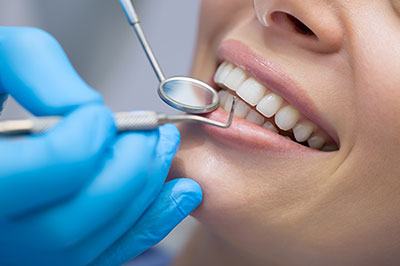 The image shows a dental professional performing dental work on a patient, with the patient's mouth open and the professional using a dental tool.